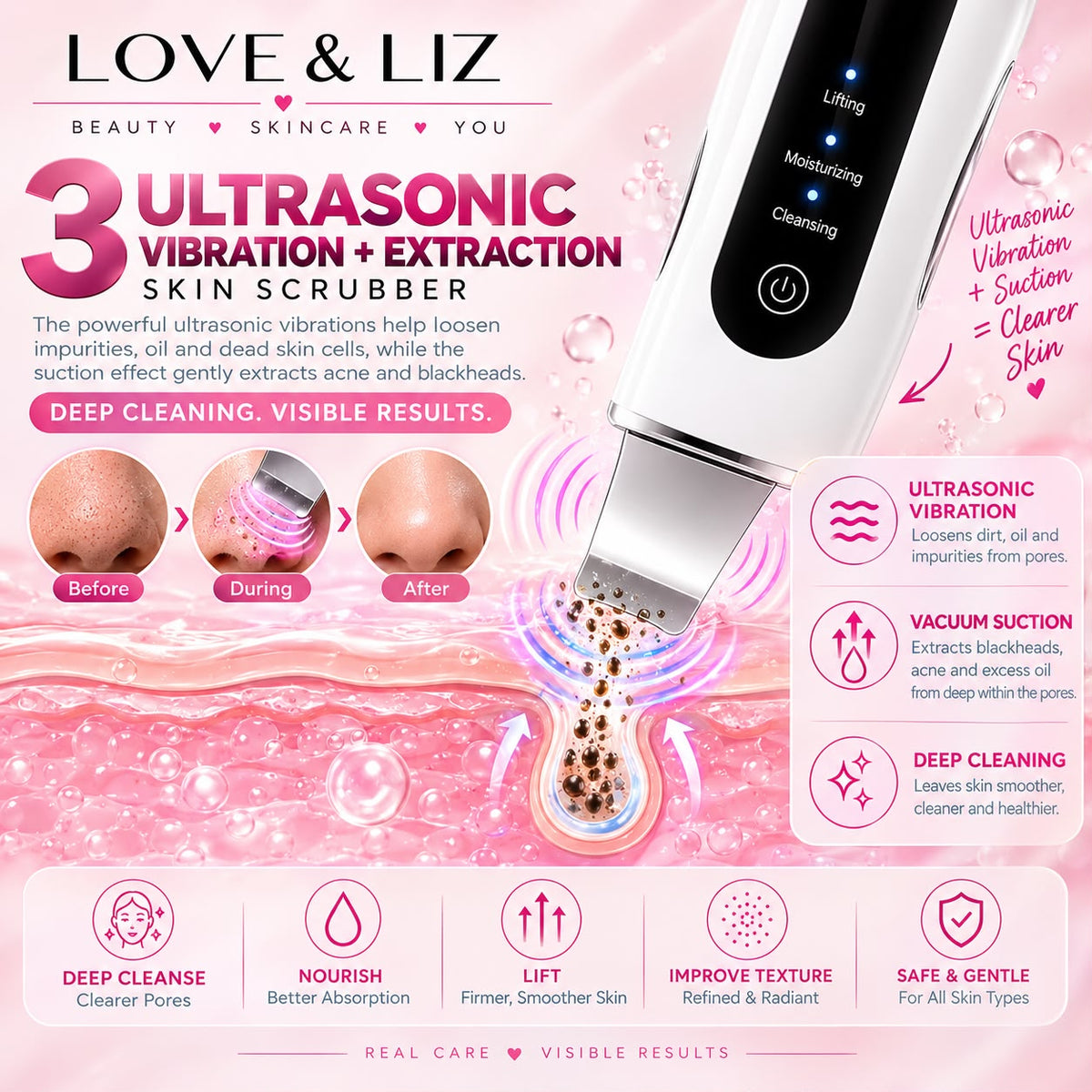 LoveAndLiz Ultrasonic Skin Scrubber
